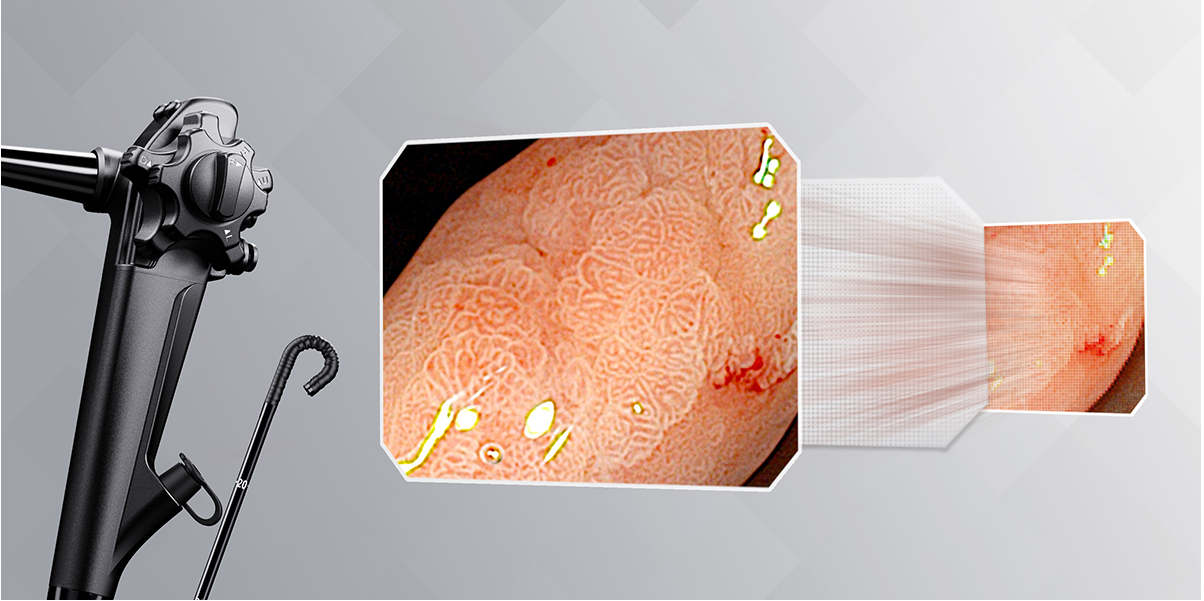 Endoscope VME-2300 Digestive Endoscope