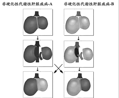 2手术原理图示