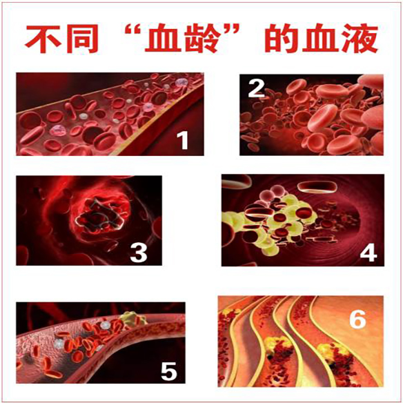 血管淤堵02-1