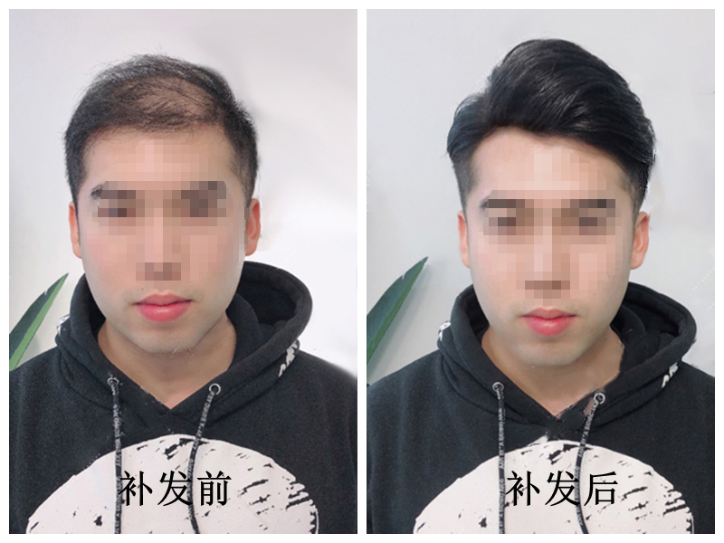 年轻51马