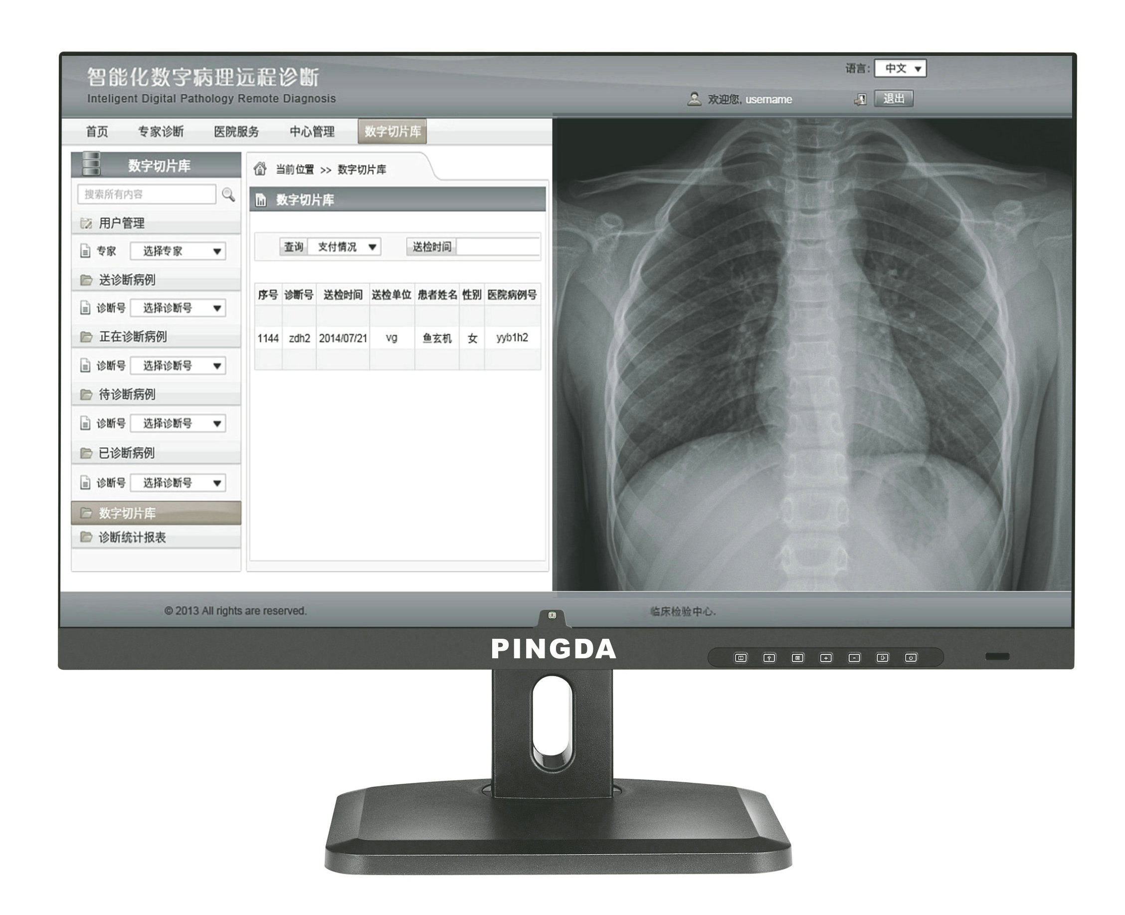 PD-3D19ME