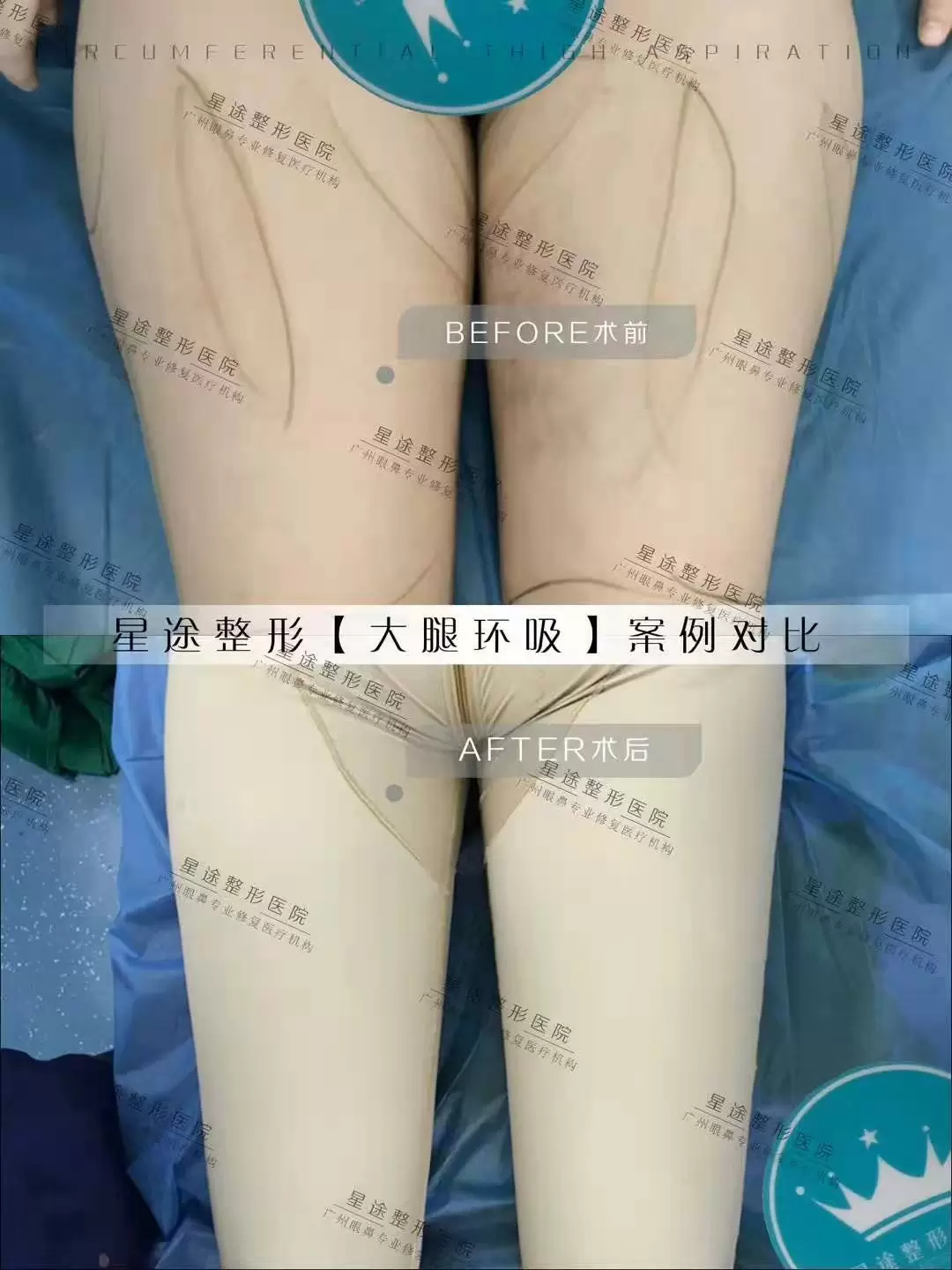 cf289589b24b43a7_html_411a7db164f517f9