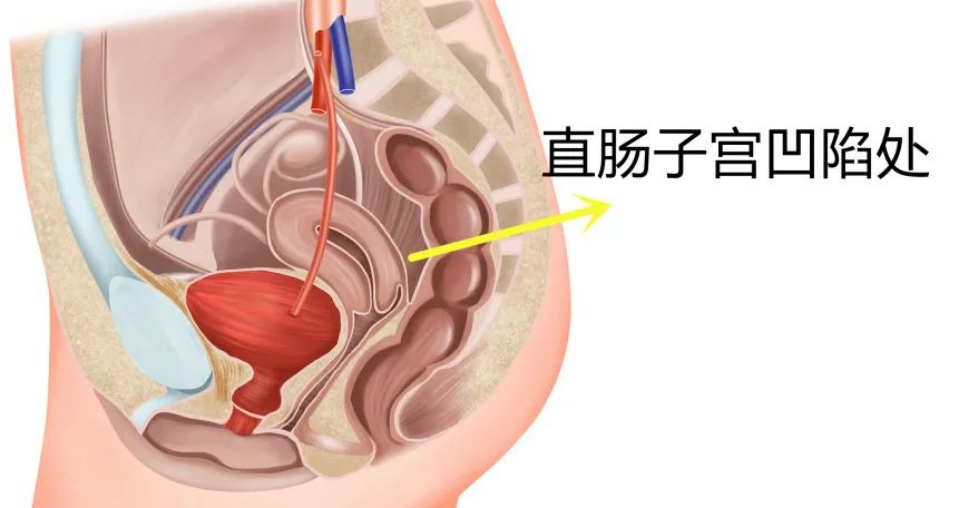 微信圖片_20240113090758