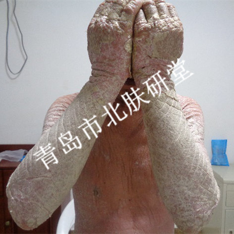 患者姜先生
