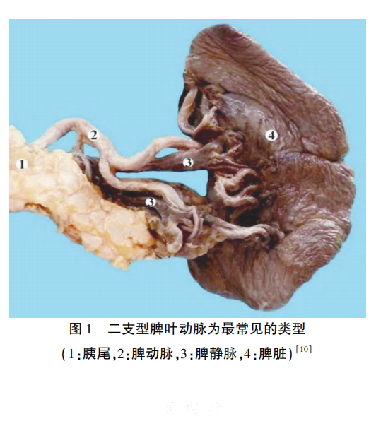 腹腔镜脾部分---图1