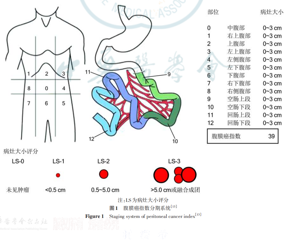 结直肠癌腹膜转移----图1