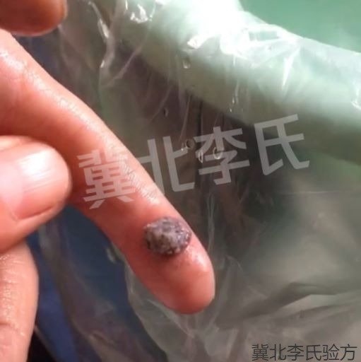刺猴图片,冀北李氏祛疣