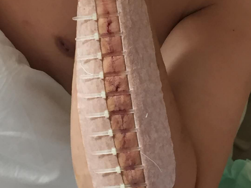 164552371213886e969ae5fa12fc8
