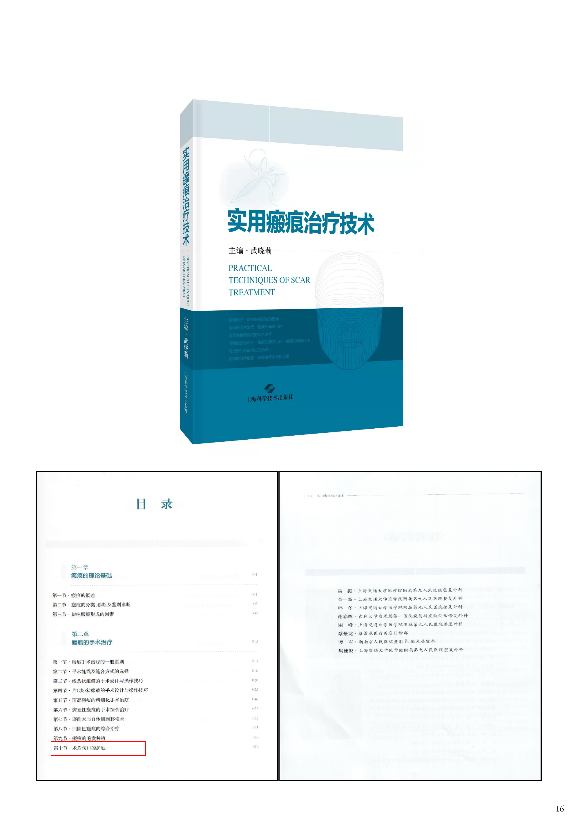缝合器文献资料_页面_20.png