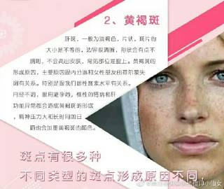 ecec94b3gy1h5xtma45w3j20sg0o179g.jpg