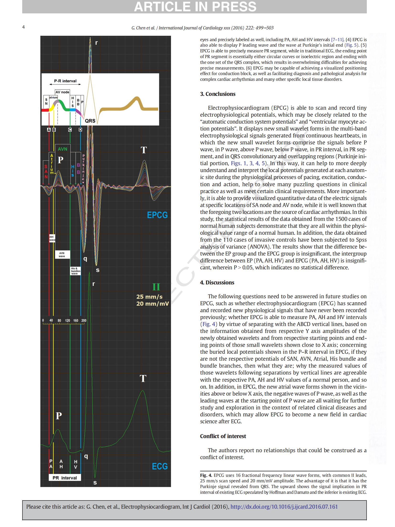 Electrophysiocardiogram For the first time EPCG has been recorded on human body surface_03