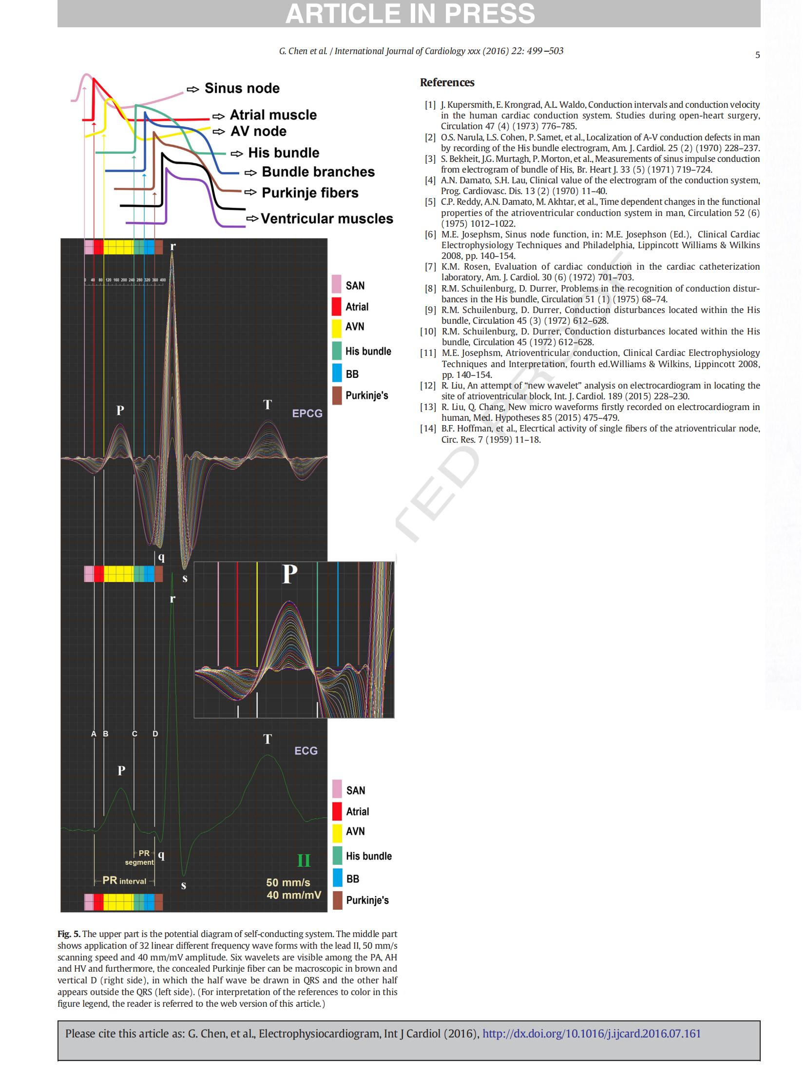 Electrophysiocardiogram For the first time EPCG has been recorded on human body surface_04