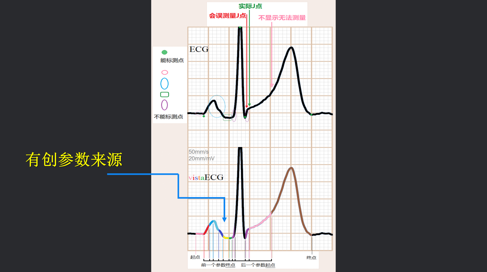 vistaECG新ECG en_08