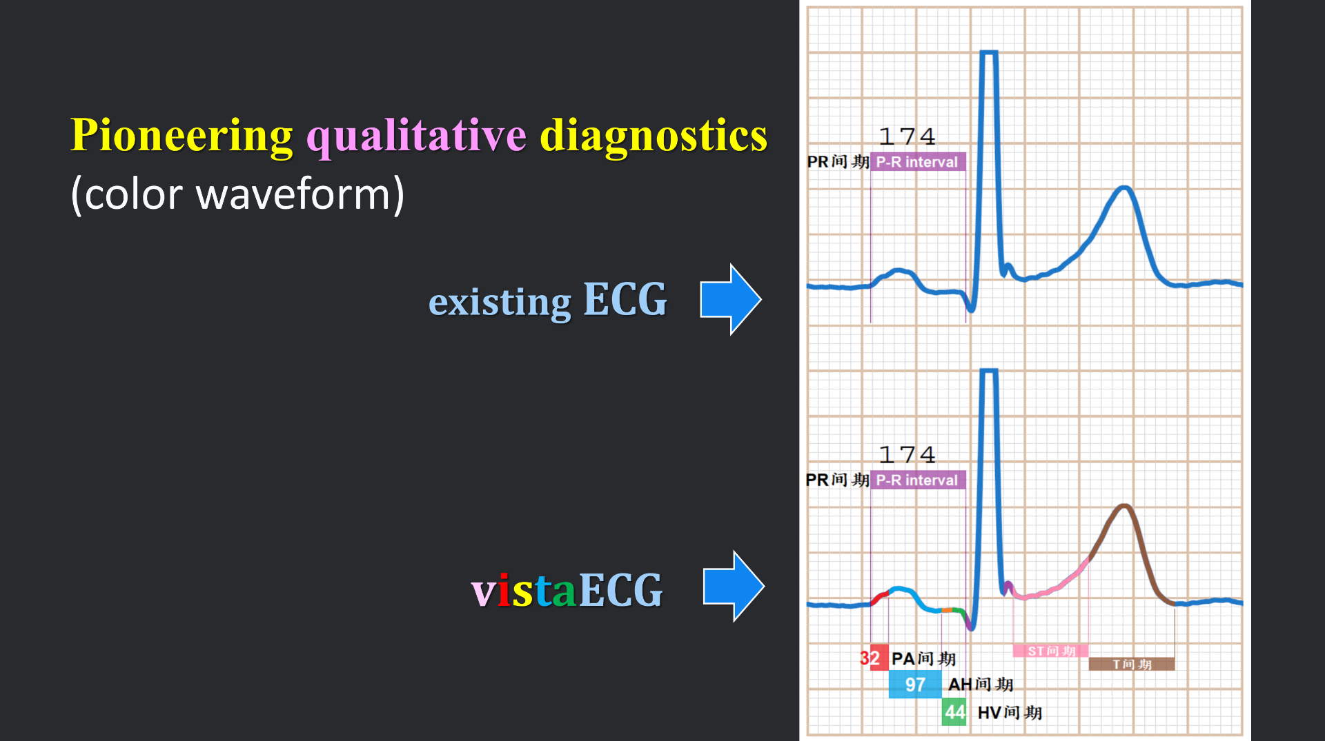 vistaECG新ECG en_10