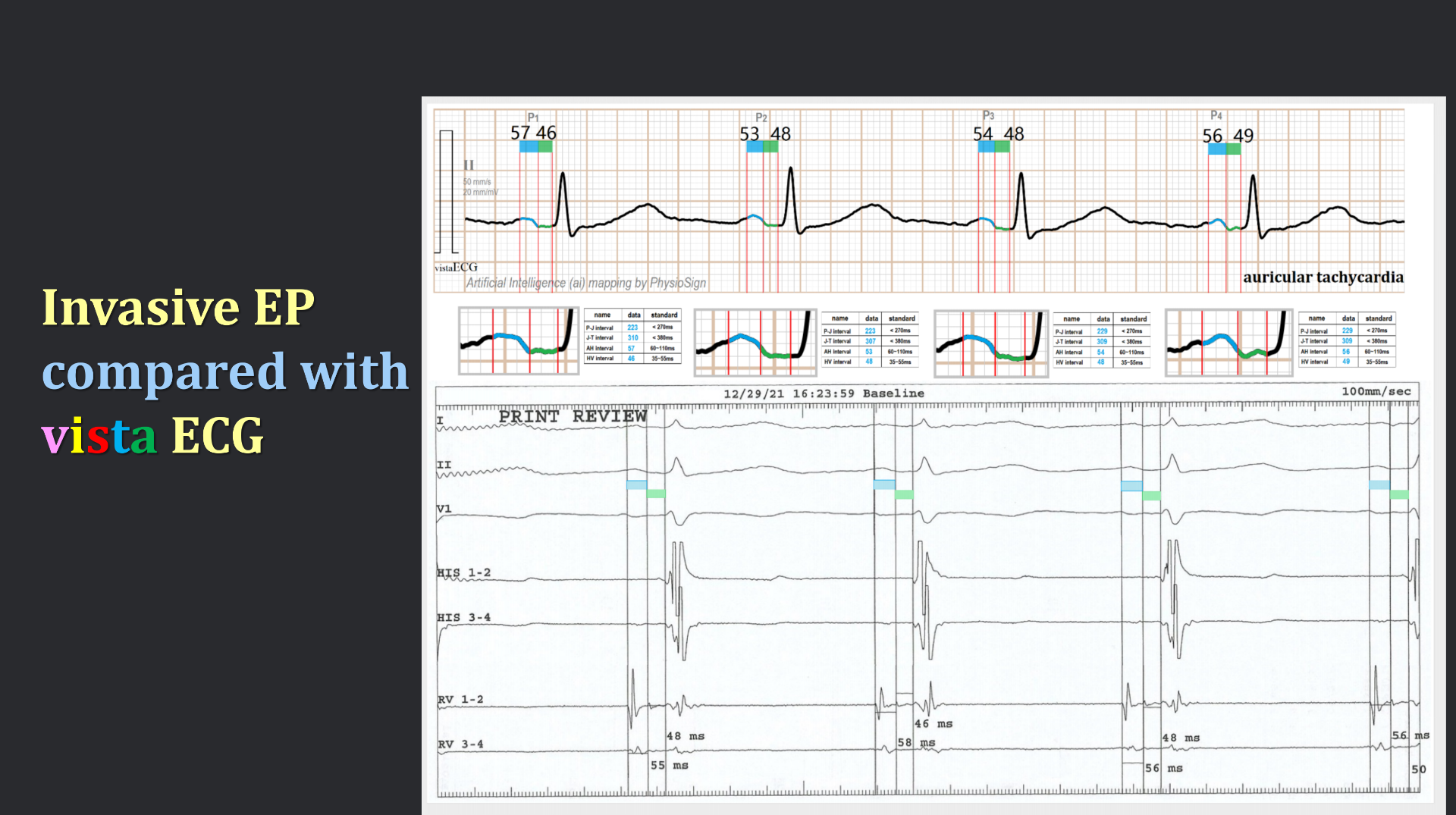 vistaECG新ECG en_14