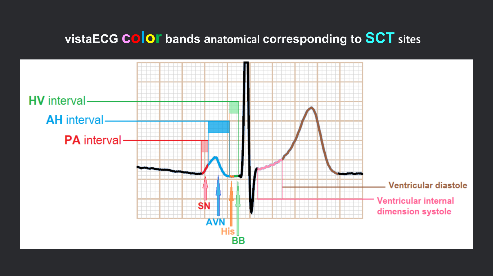 vistaECG新ECG en_18