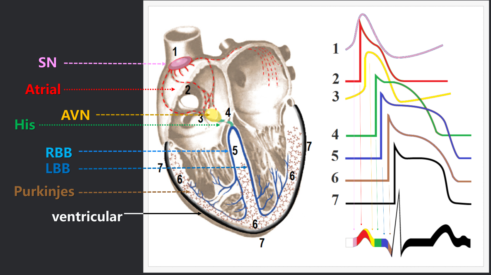 vistaECG新ECG en_17