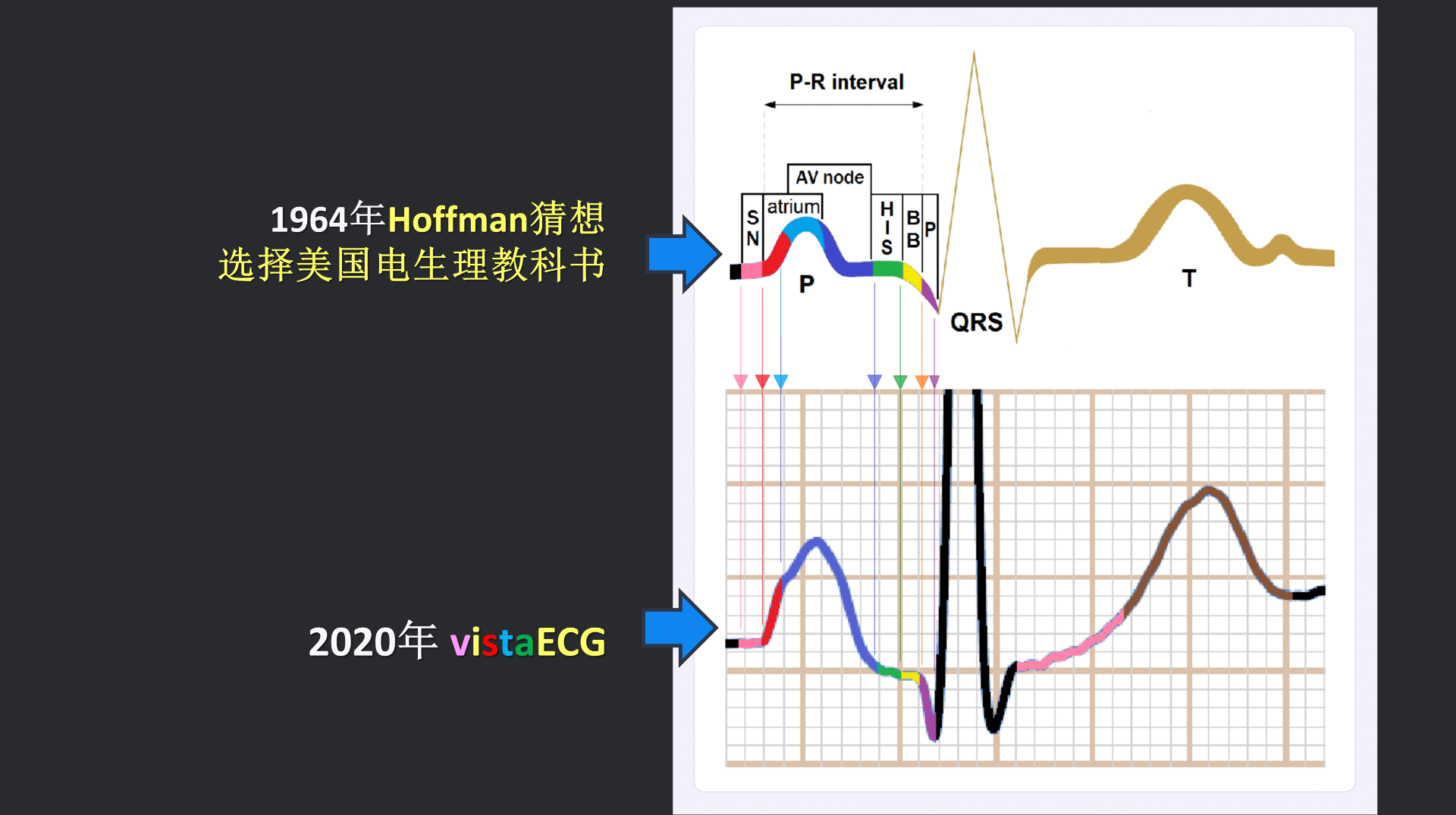 vistaECG新ECG en_19