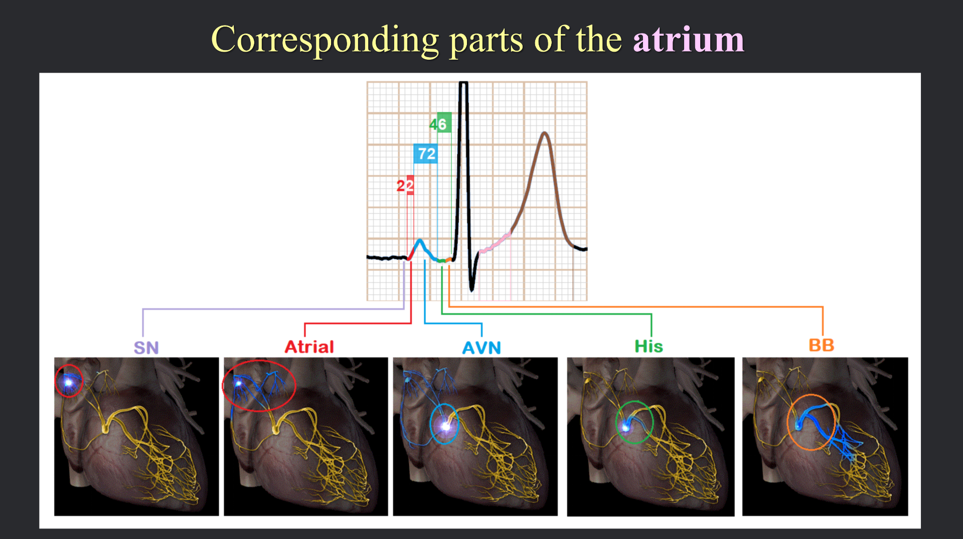 vistaECG新ECG en_22