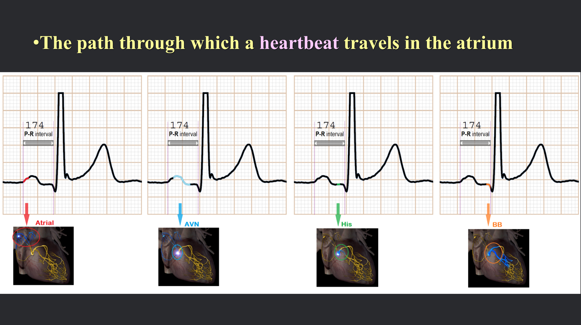 vistaECG新ECG en_23