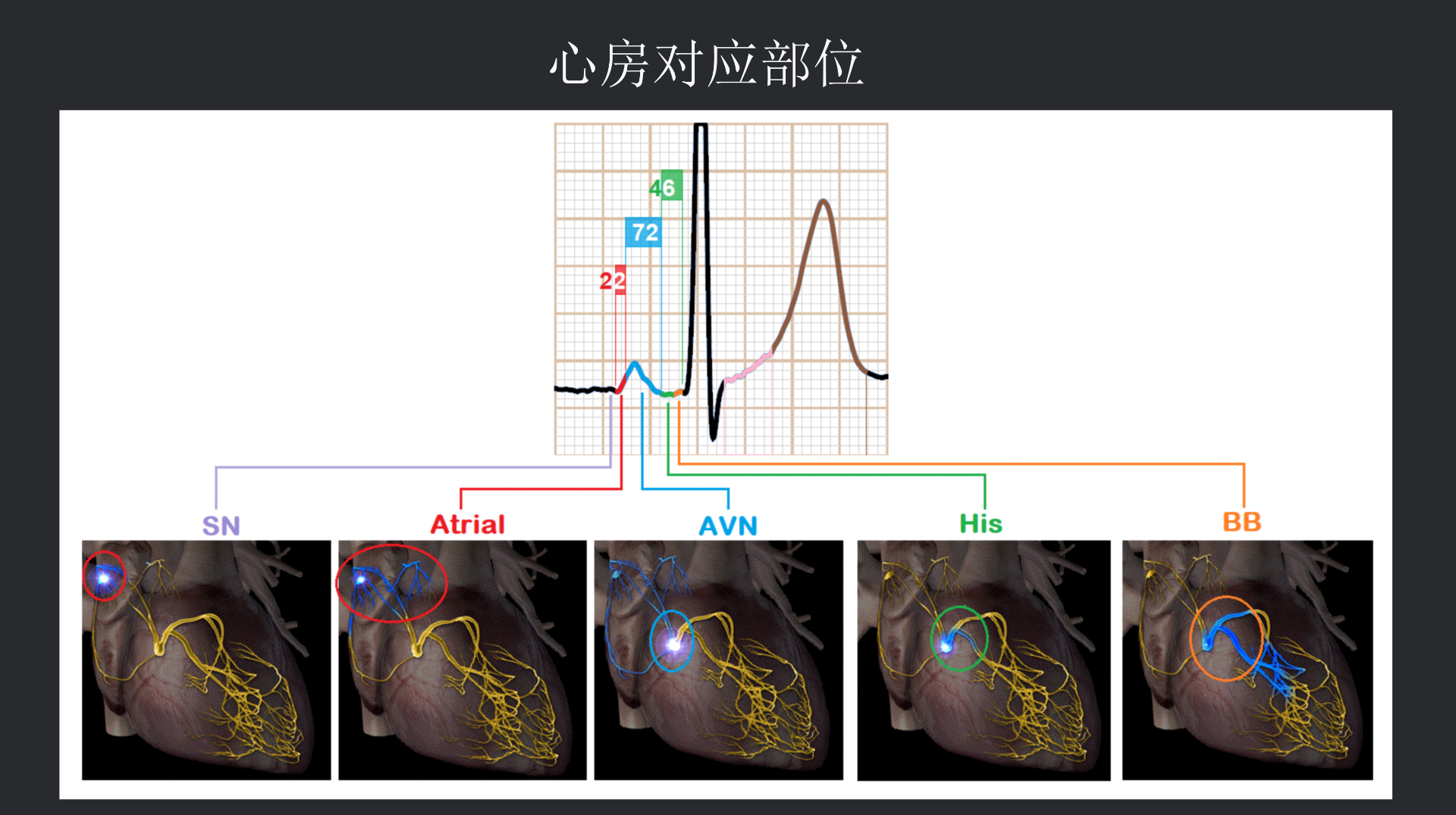 vistaECG新ECG en_26