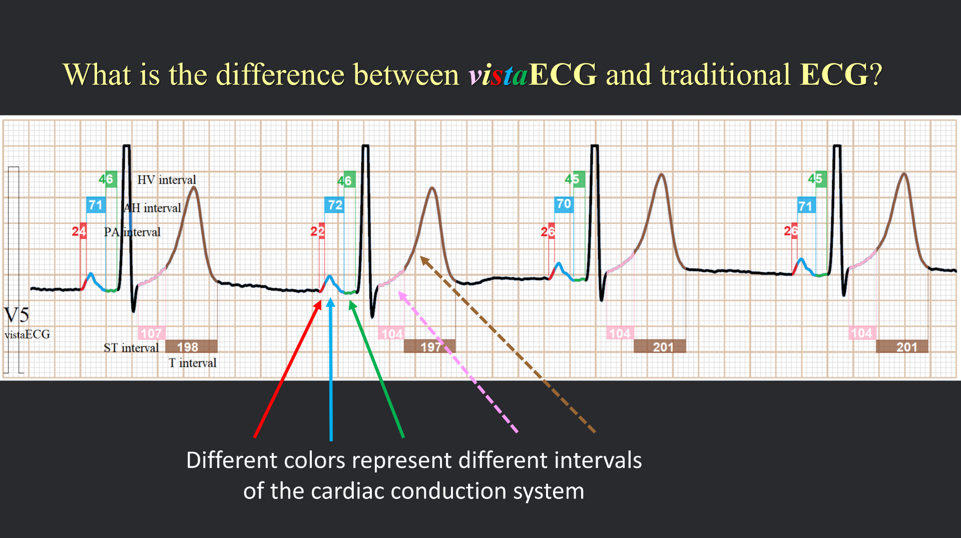 vistaECG新ECG en_24