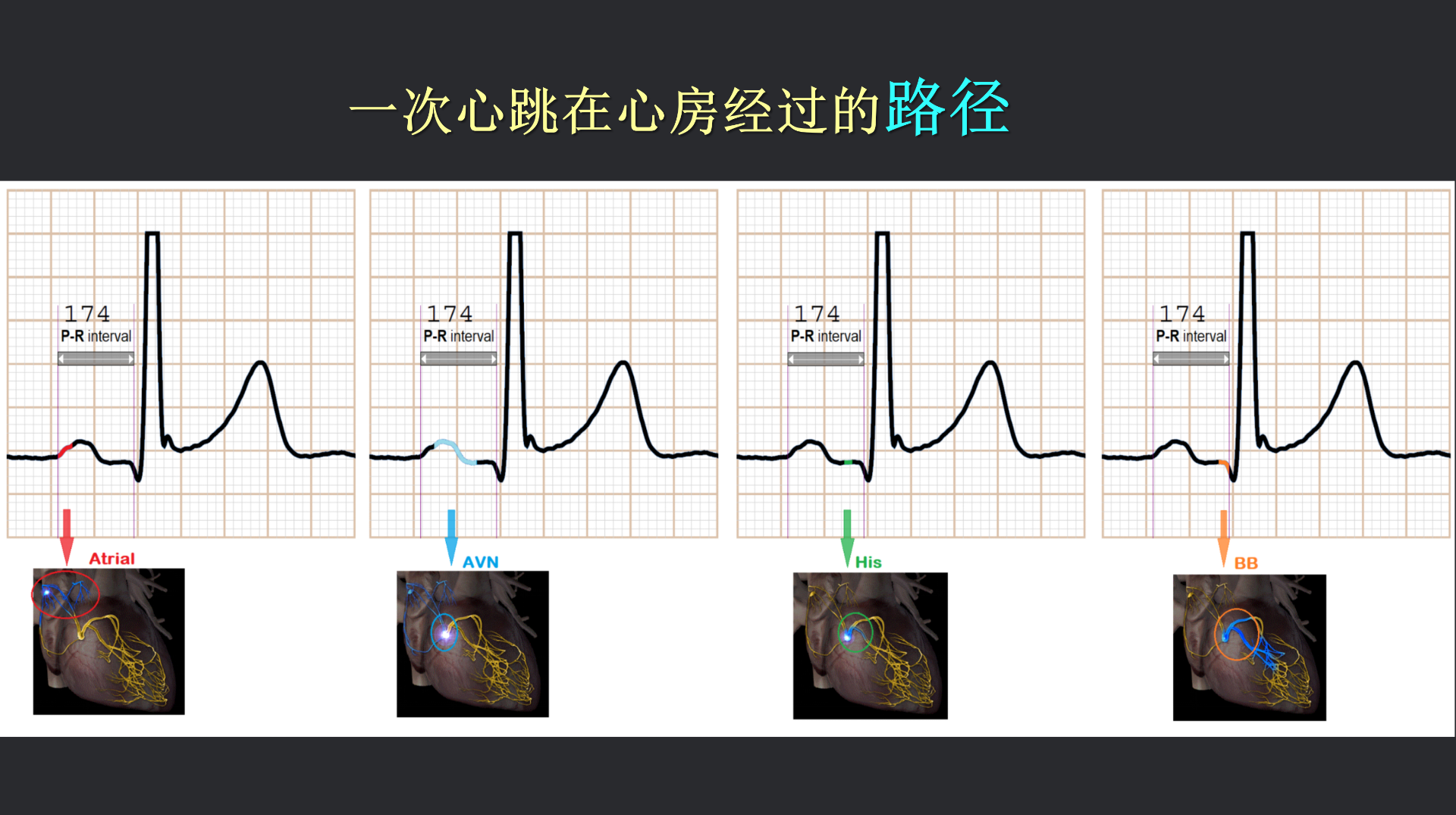 vistaECG新ECG en_27