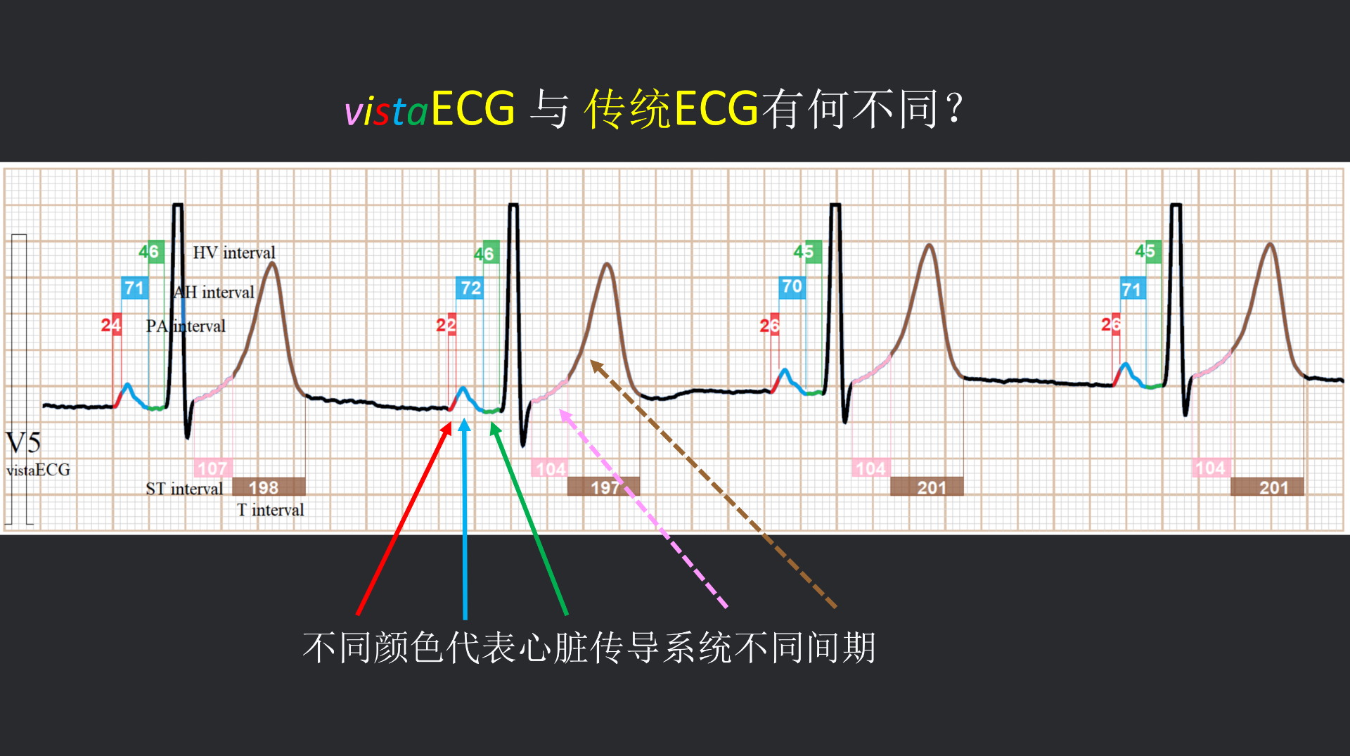 vistaECG新ECG en_28