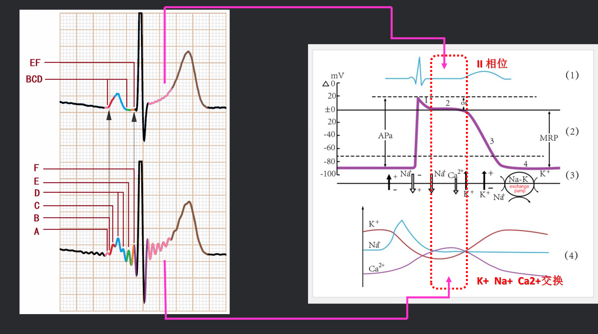 vistaECG新ECG en_30