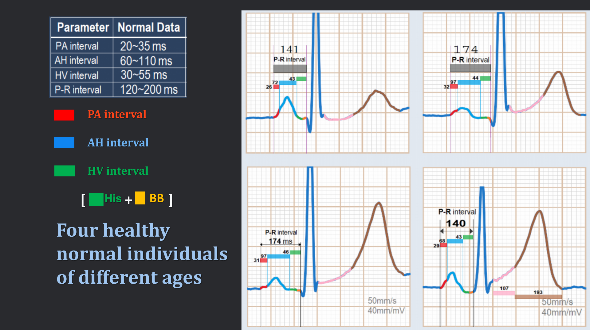 vistaECG新ECG en_33