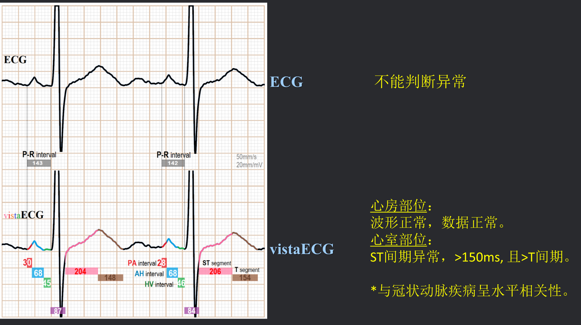 vistaECG新ECG en_37