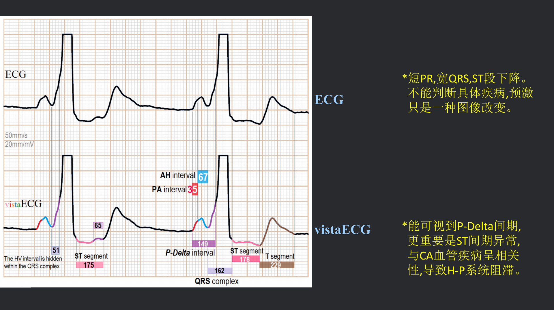 vistaECG新ECG en_38