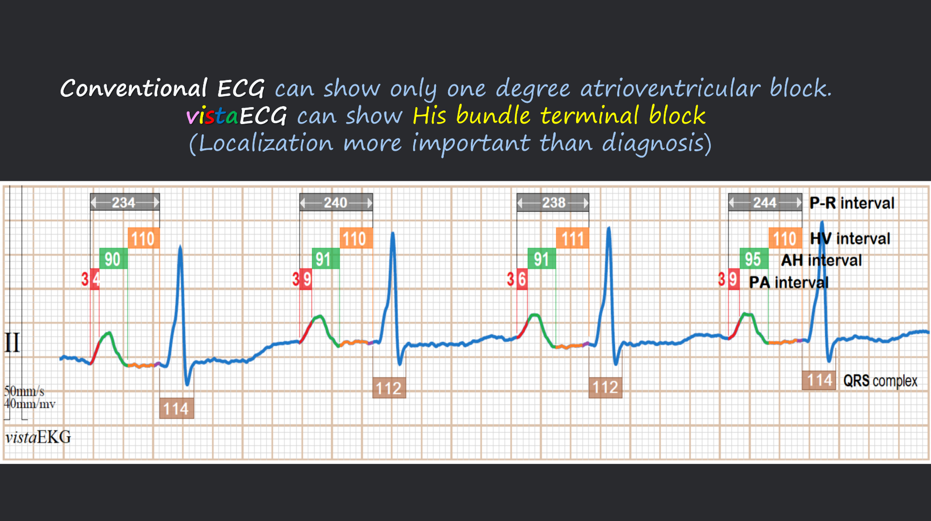 vistaECG新ECG en_40