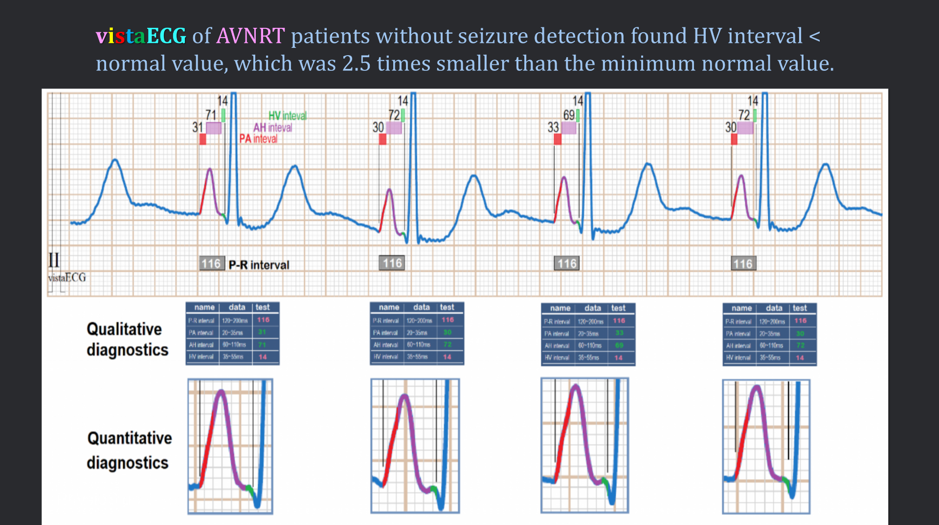 vistaECG新ECG en_44