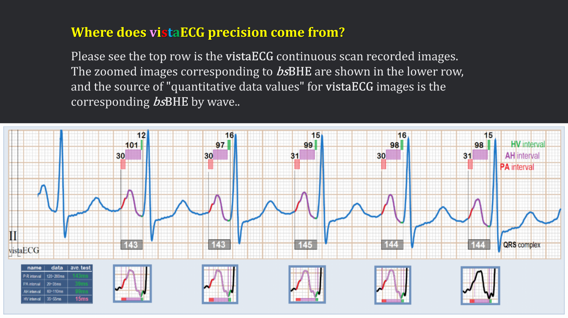 vistaECG新ECG en_45