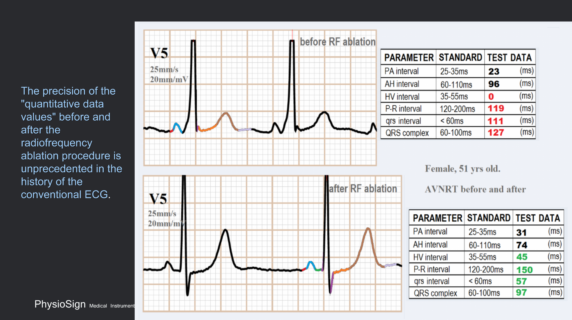 vistaECG新ECG en_46