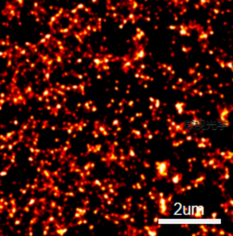 Pathological marker recognition imaging