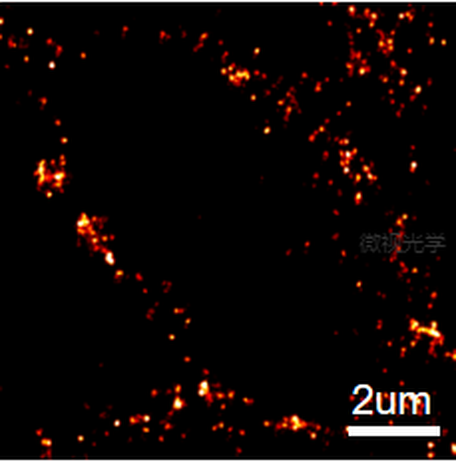 Tissue level super-resolution imaging