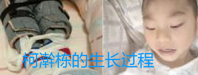 重5