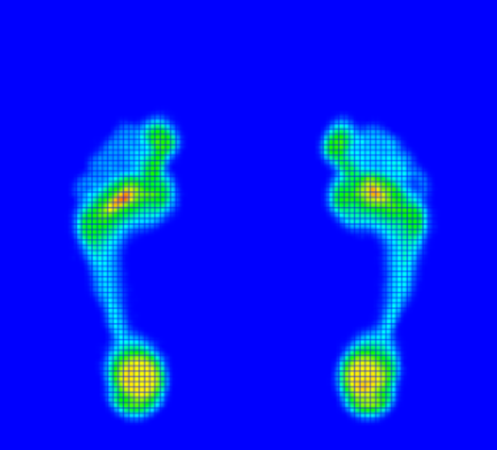second-foot-image-for-blog-2-diabetic-foot-module_20250113_17367365350876830