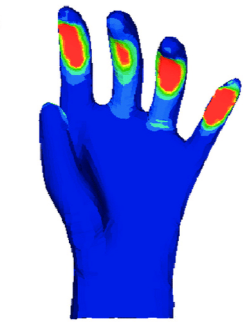 Simulated-contact-pressure-distribution-MPa_20250119_17372696863521260