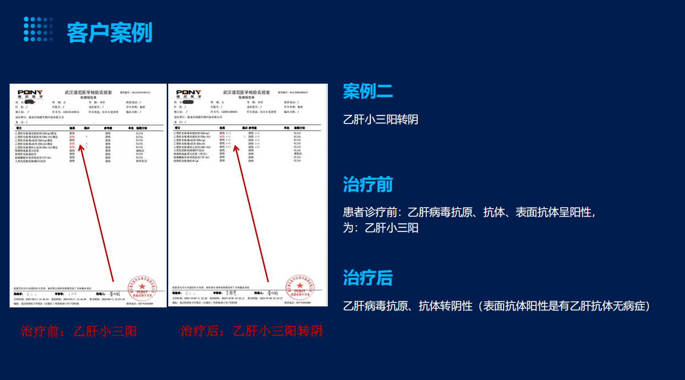 患者诊疗前：乙肝病毒抗原、抗体、表面抗体呈阳性，为：乙肝小三阳
治疗后
乙肝病毒抗原、抗体转阴性（表面抗体阳性是有乙肝抗体无病症）
