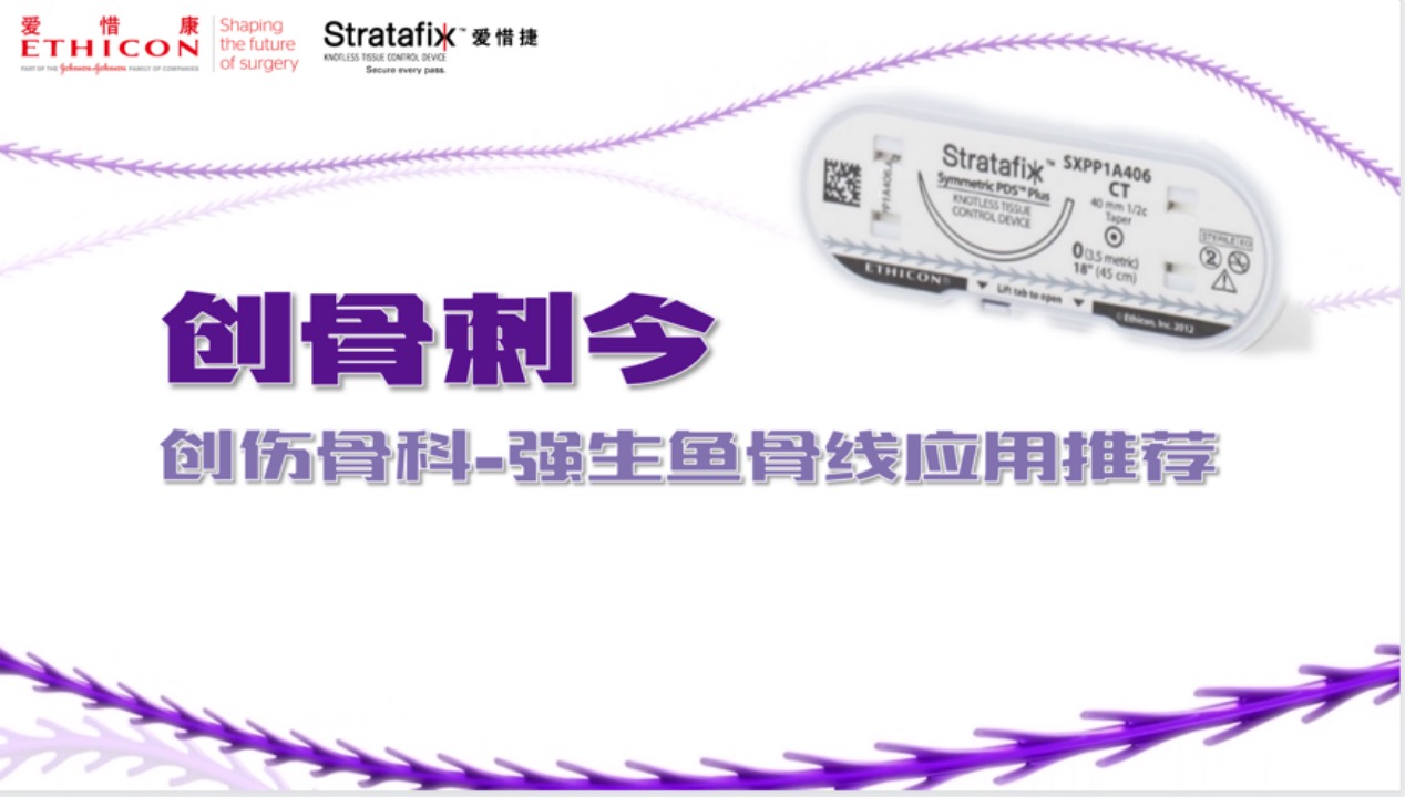 强生鱼骨线
