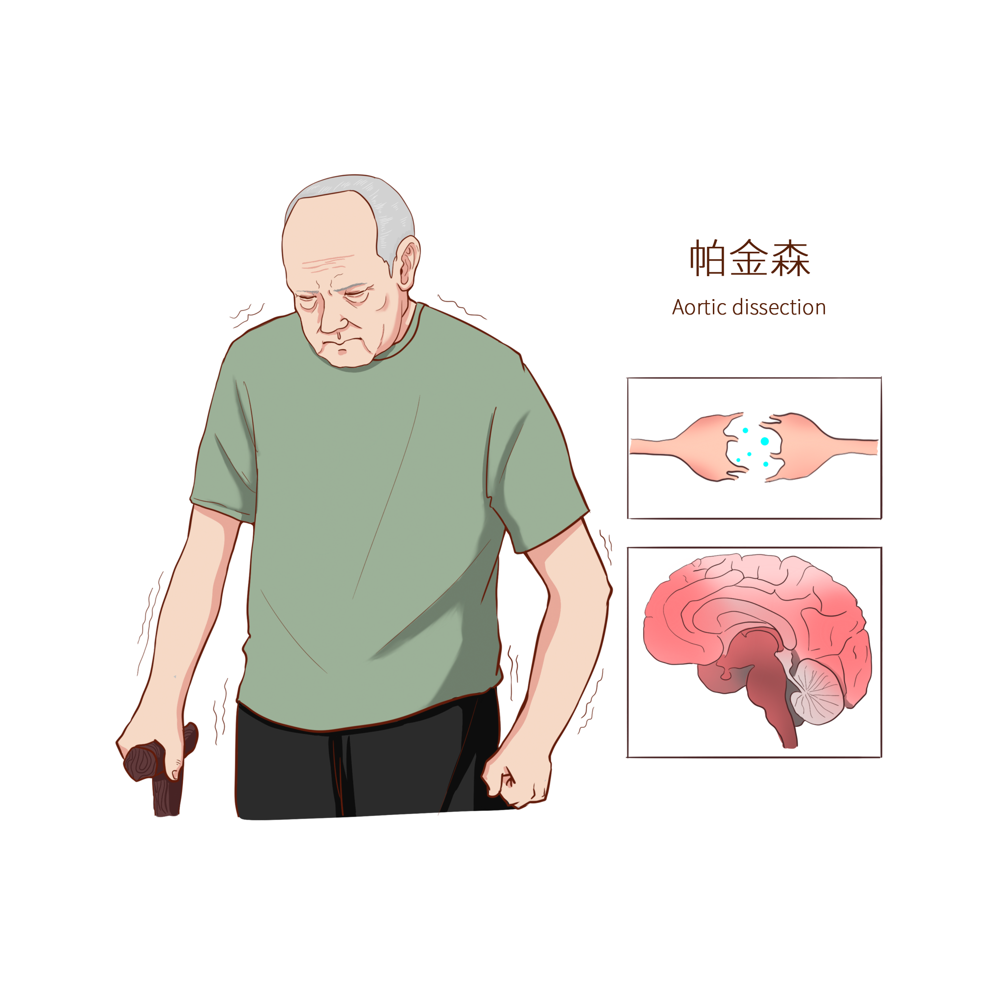 千库网_常见医疗人物疾病图例帕金森_元素编号14589924