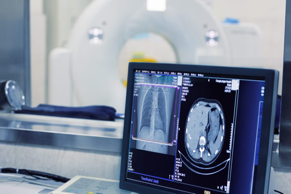 项目包含了常见的肿瘤标志物及胸部螺旋CT的检查