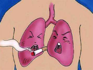 肺癌7.jpg