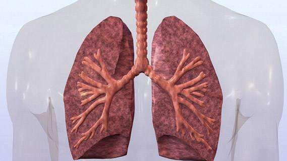 肺部纤维化3.jpg