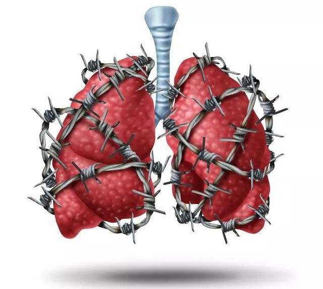 肺部纤维化4.jpg