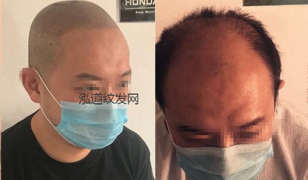 纹发案例效果图12