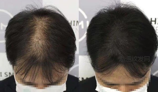 纹发案例效果图11
